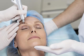 Blefaroplastica non chirurgica Novara