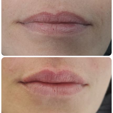 medico chirurgo estetico novara botox filler