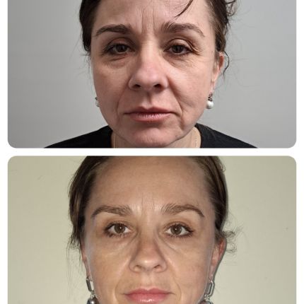 medico chirurgo estetico novara botox filler