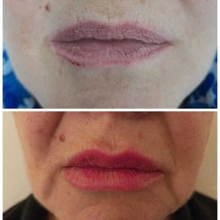 medico chirurgo estetico novara botox filler