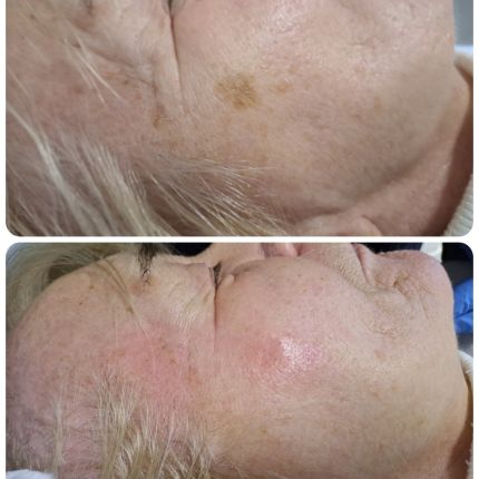 medico chirurgo estetico novara botox filler