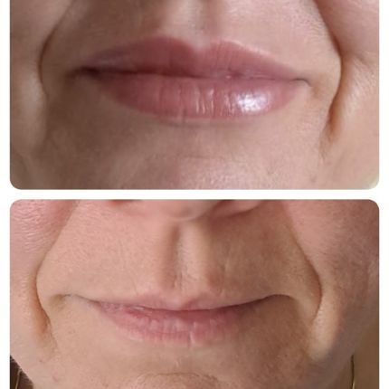 medico chirurgo estetico novara botox filler